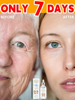 Učinkovit Anti aging lifting obraza serum rešitev starostnih linij anti-aging in gube obraza gubam, odstranjevalec